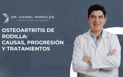 Osteoartritis de rodilla: causas, progresión y tratamientos