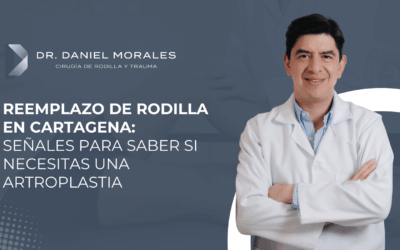 Reemplazo de rodilla en Cartagena: señales para saber si necesitas una artroplastia