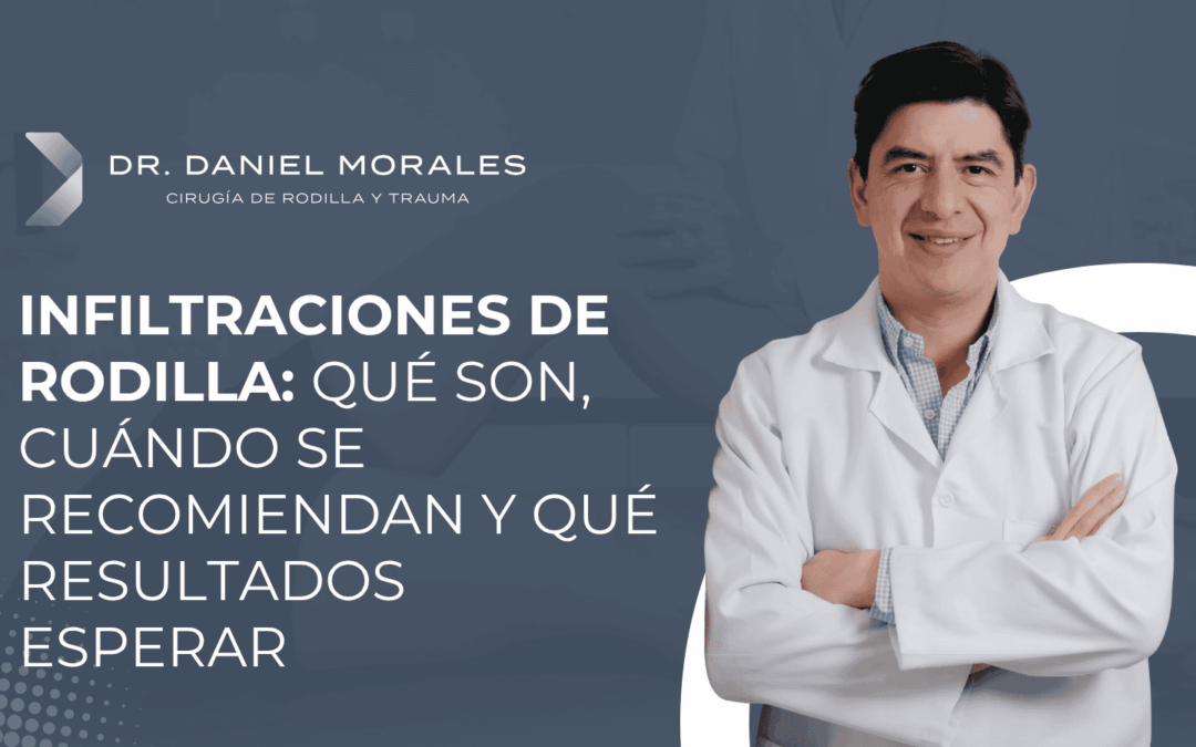 Infiltraciones de rodilla: qué son, cuándo se recomiendan y qué resultados esperar